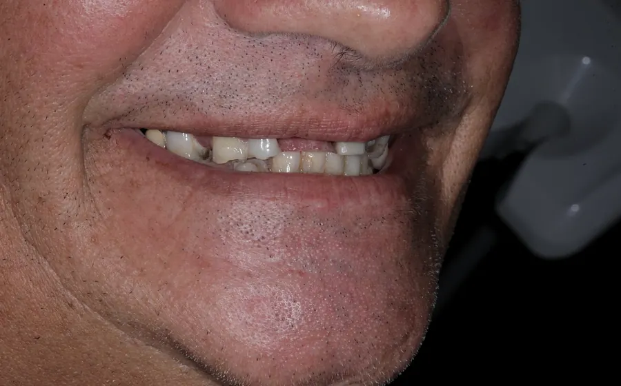 Prima del trattamento, dettaglio sorriso autorizzato